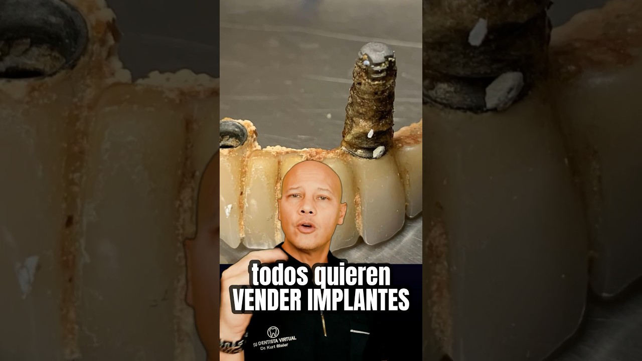 los implantes dentales desgravan en hacienda